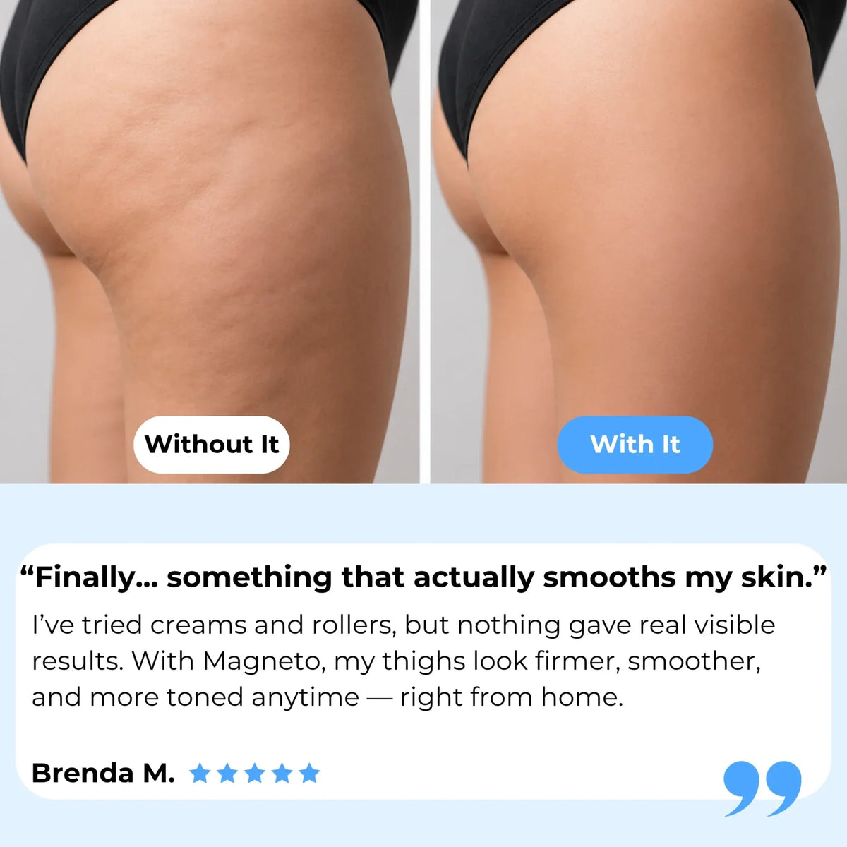 Magneto BodyGlow Pro™ Smart Cellulite & Body Sculpting Massager - Magneto